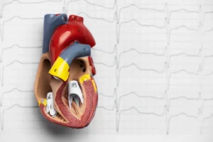 ENFERMEDAD CARDIOVASCULAR